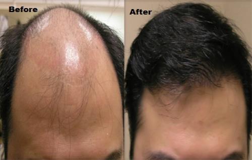 Hair Treatments 3